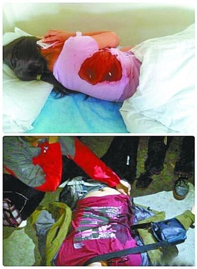 華山捅游客嫌犯未經傷者辨認 警方稱沒來得及